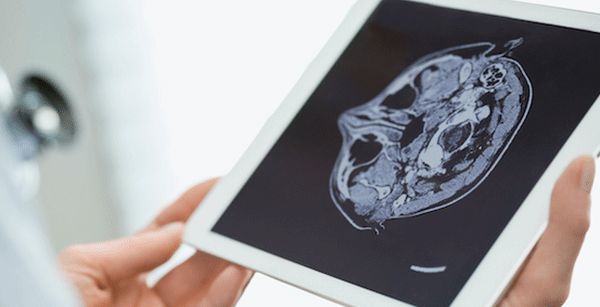 Brain scan on iPad device